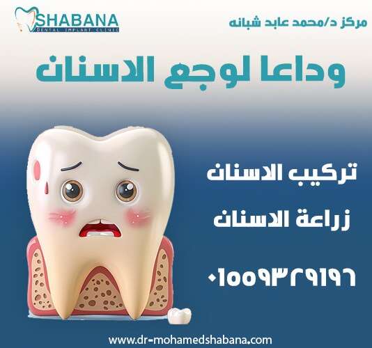 زراعة الاسنان تركيبات الاسنان